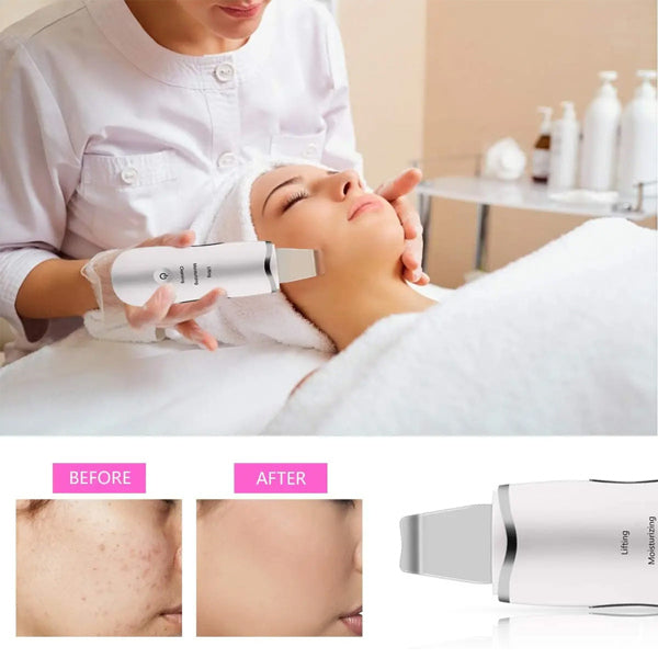 3-in-1 Ultrasonic Skin Scrubber Deep Vibrate Facial Cleaner Shovel Face Scrubber Peeling Black Head Remover Facial Massager