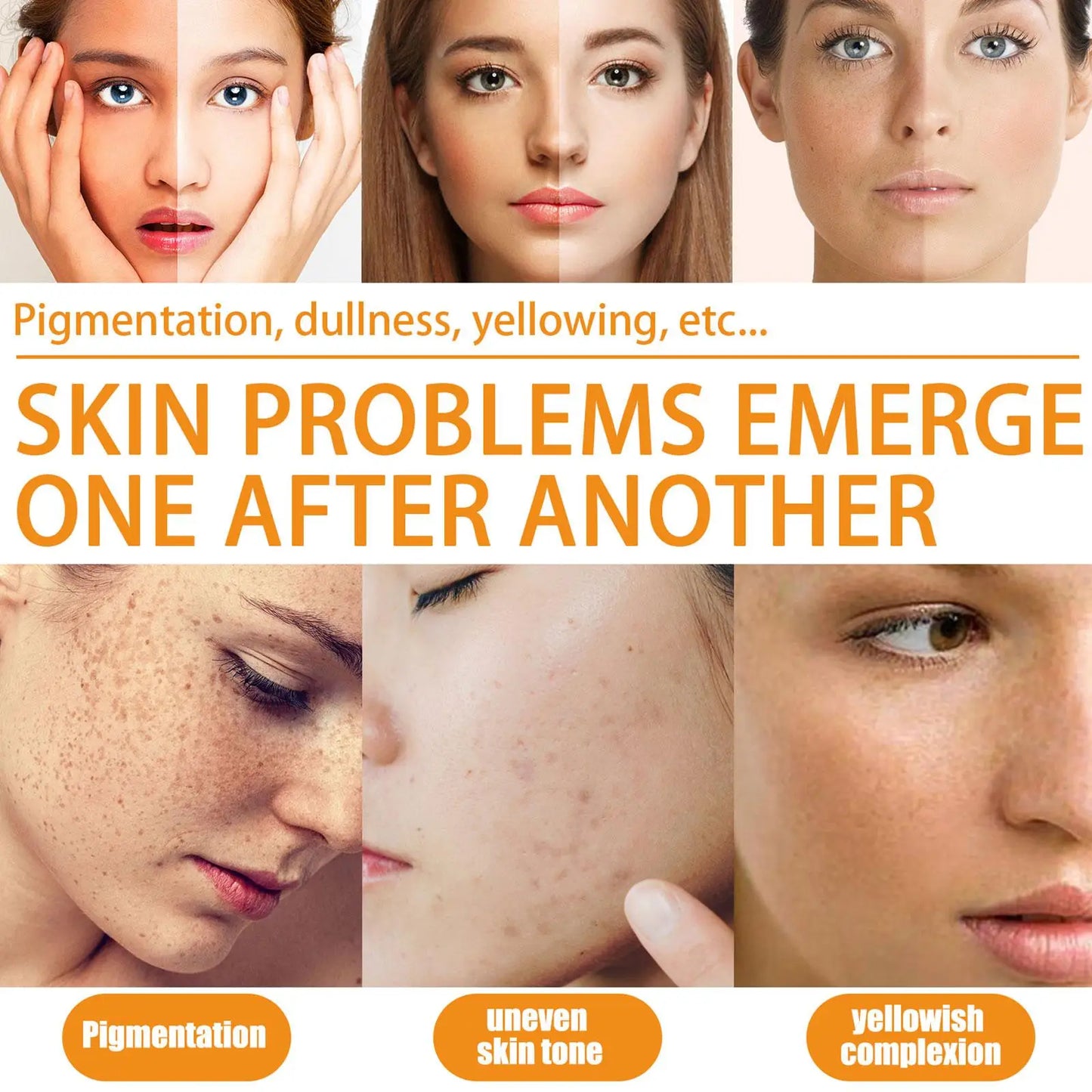 Suero de vitamina C para blanquear el rostro, suero facial con ácido hialurónico, removedor de manchas oscuras, productos coreanos para el cuidado de la piel.