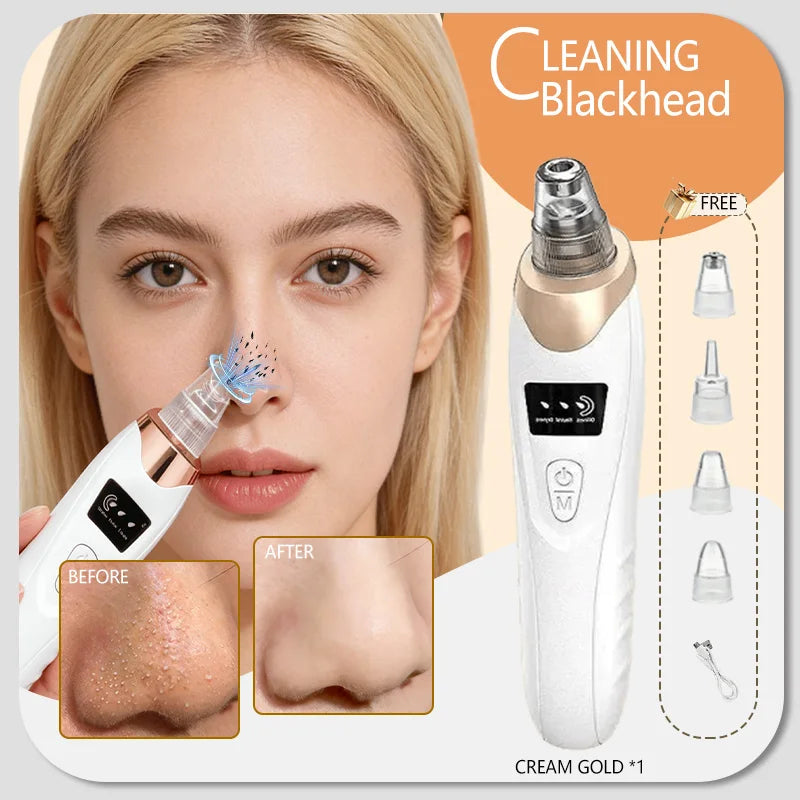 Electric Blackhead Remover Vacuum – Pore Cleaner & Acne Extractor | Facial Deep Cleaning Tool