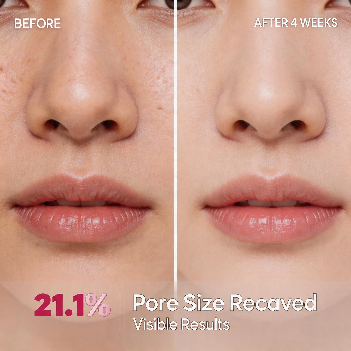 Cyano Pink Spicule Serum with Vitamin B12, Liquid Microneedle Pore Refining Face Essence, Niacinamide for Skin Texture Renewal,