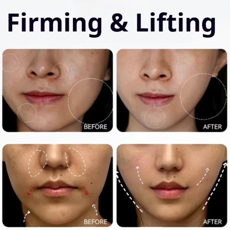 V Face Shaped Massager Red Light Therapy Micro-current Face Shaping Machine Skin Care Lifting Facial Home Use Beauty Devices