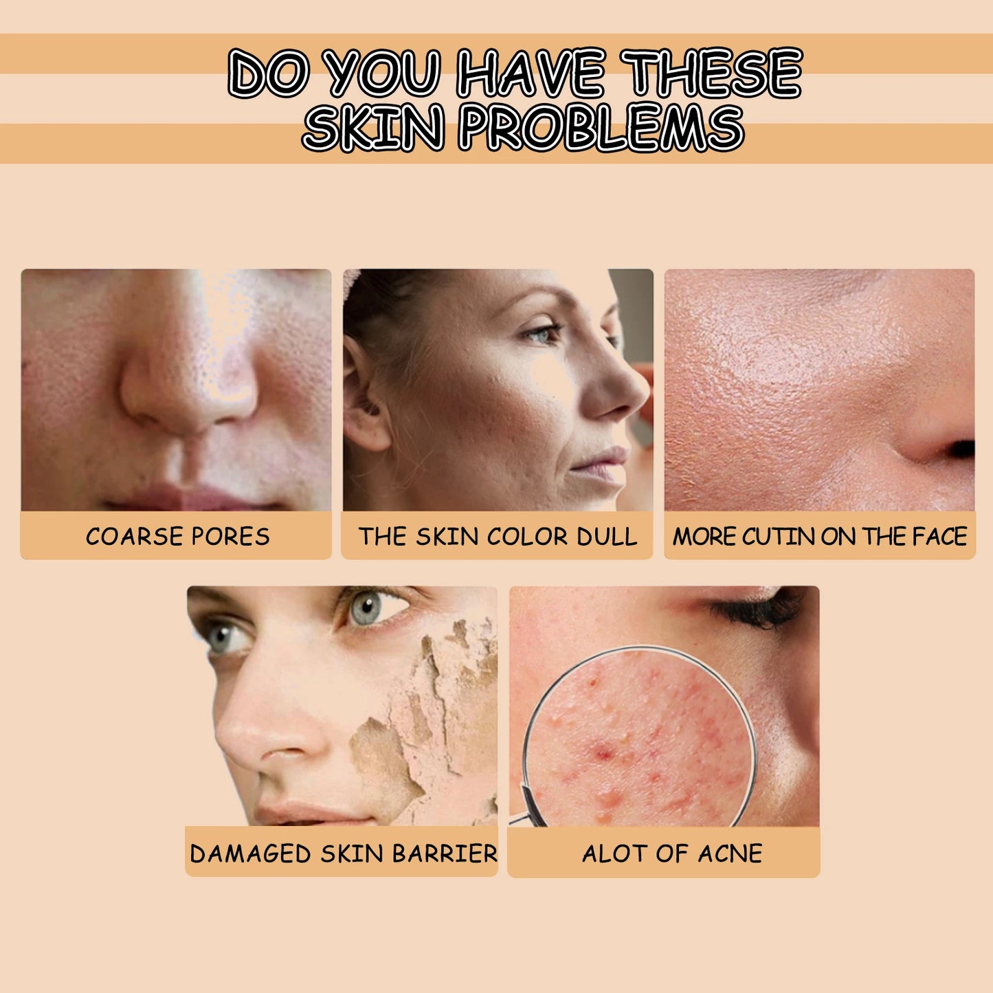 Niacinamide Serum Dark Spots Removal Sebum Control Reduces Dryness Brightening Glowing Skin Moisturizing Hydrating Face Essence