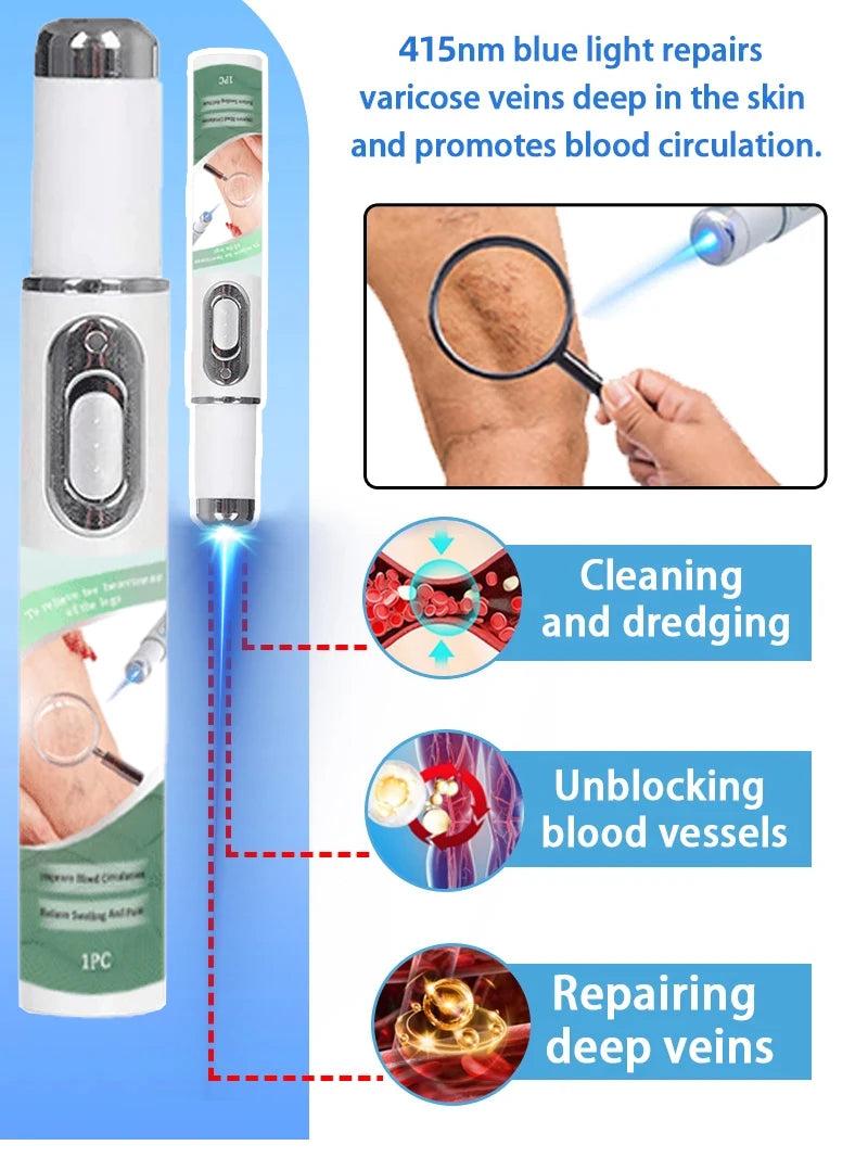 2026 New Blue Light Pen to Solve Venous insufficiency Legs care Tools