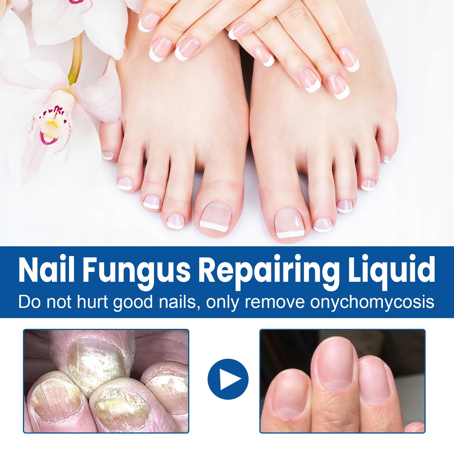 West&Month Nail Fungus Repair Liquid Hand Foot Skin Care Serum Remove Infected Thicken Bright Fungal Treat Soft Hand Foot Care