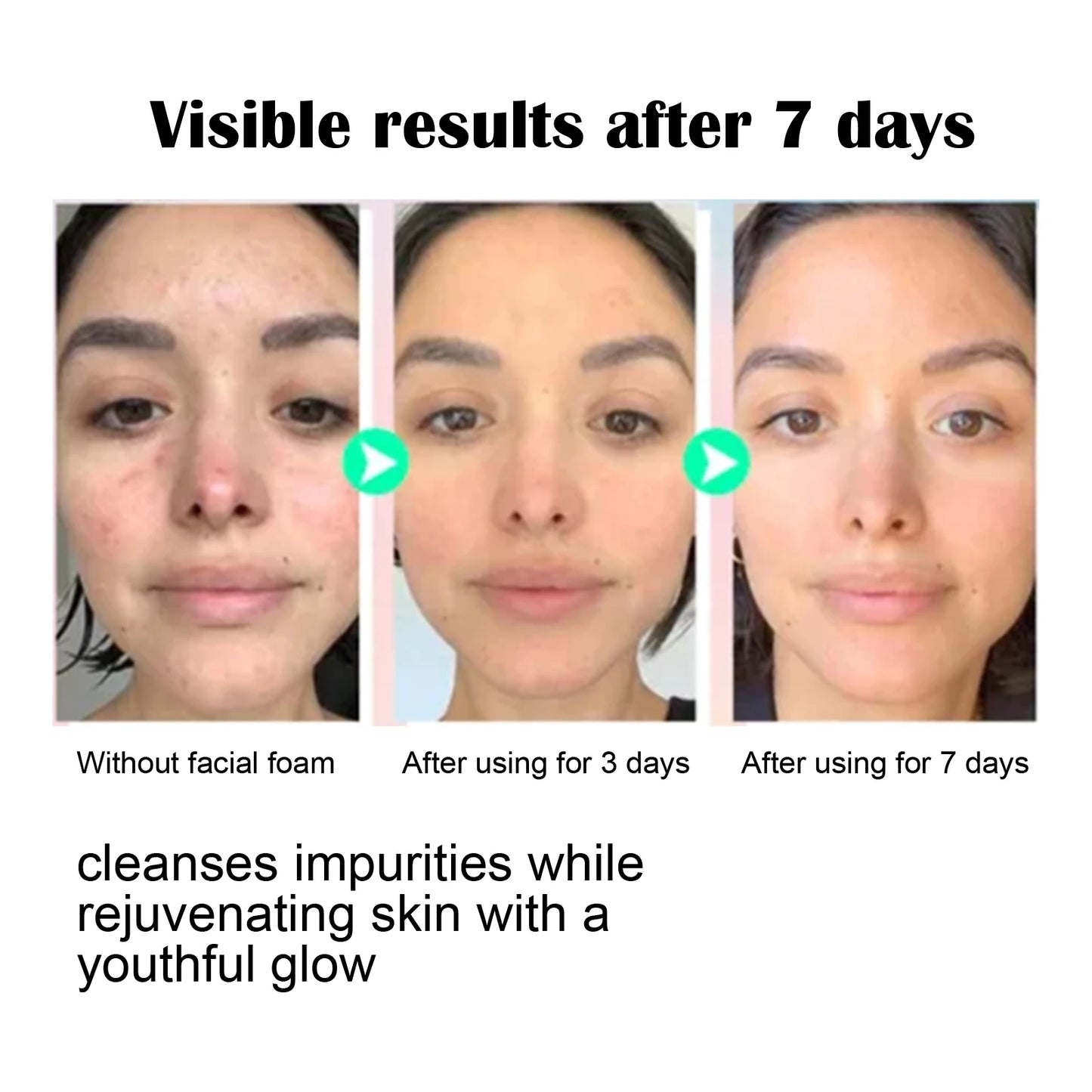 Eelhoe 100g Moisturizing Cleanser Gentle Facial Cleaning Daily Skin Care Hydrating Skin Maintenance