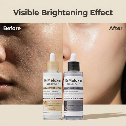 Black Rice Exfoliating Ampoule 80ml, Rice Water Extract, AHA BHA, Niacinamide, All Skin Types
