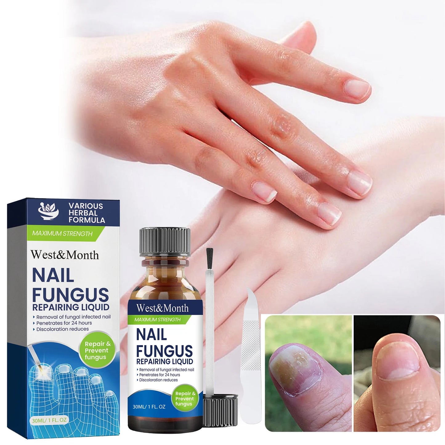 West&Month Nail Fungus Repair Liquid Hand Foot Skin Care Serum Remove Infected Thicken Bright Fungal Treat Soft Hand Foot Care