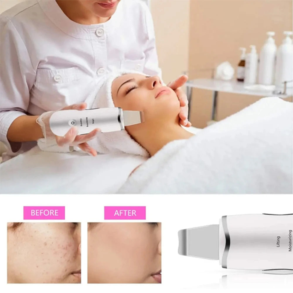 3-in-1 Ultrasonic Skin Scrubber Deep Vibrate Facial Cleaner Shovel Face Scrubber Peeling Black Head Remover Facial Massager