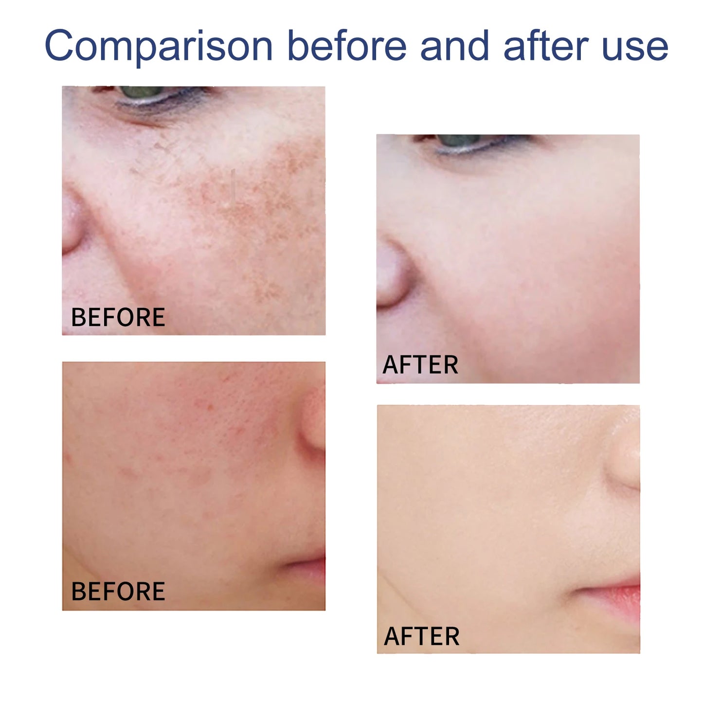 Eelhoe 100g Moisturizing Cleanser Gentle Facial Cleaning Daily Skin Care Hydrating Skin Maintenance