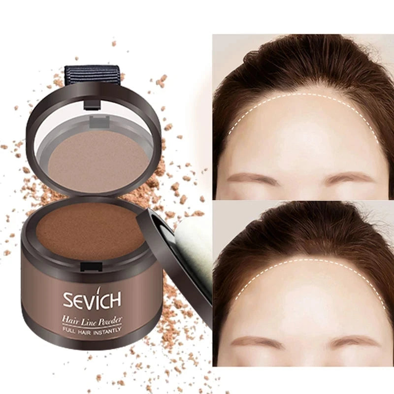 MMAlto Sevich Hairline Shadow Powder 4g – Hair Concealer for Thinning Hair & Hairline Coverage
