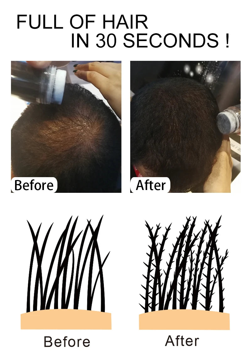 Sevich 10 Colors Hair Fibers Keratin 25g Hair Building Fibers Thickening Spray Hair Loss Products Instant Regrowth Powders