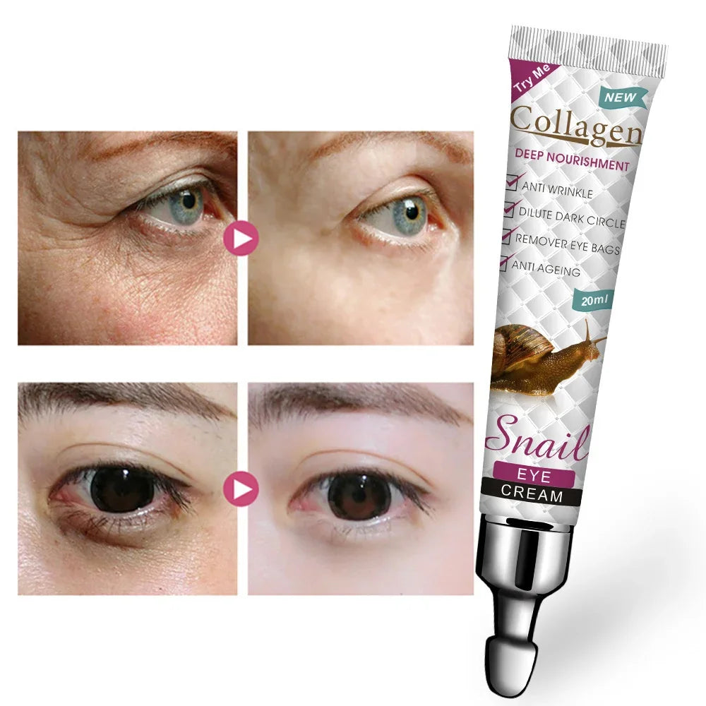 Fat Granules Remover Eyes Cream Improve Eye Bag Fade Fine Lines Moisturizing Anti-Puffiness Lifting Firming Skin Care Products