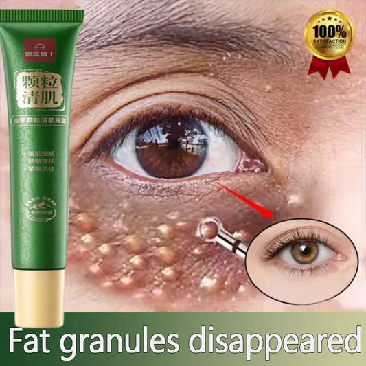 Fat Granules Remover Eye Cream Anti-Puffiness Anti Inflammatory Reduce Dark Circles Eyebags Fade Lines Moisturizing Eye Care