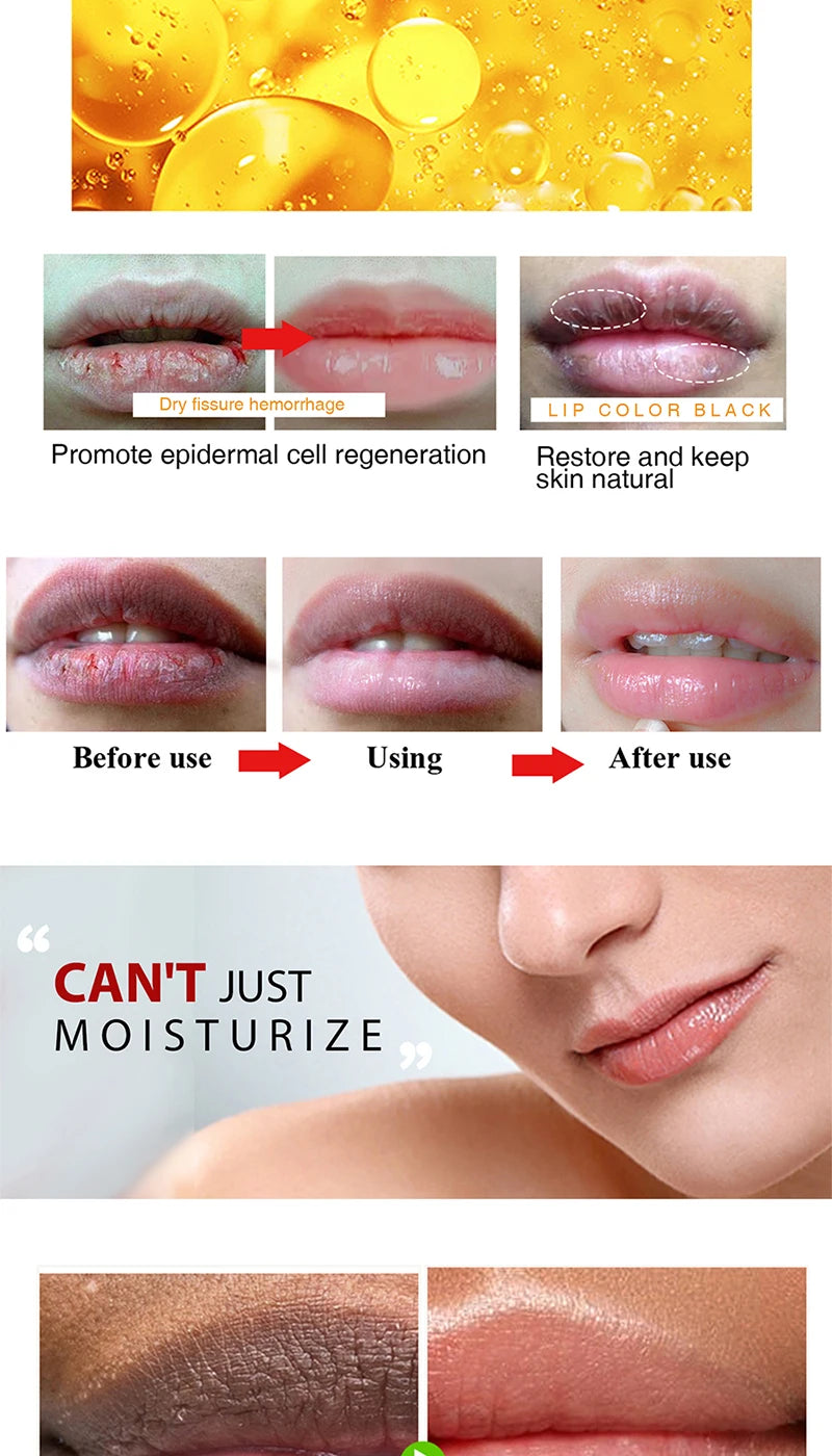 Lip Balm Remove Dark Lips Eliminate Dark Marks - Smooth Lip Lines Prevent Dryness Remove Black Pigment Lip Care Treatment