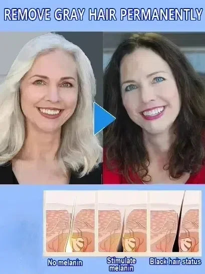 White hair killer, remove gray hair and restore natural hair color in 7 days 2025