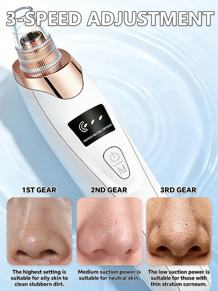 Electric Blackhead Remover Vacuum – Pore Cleaner & Acne Extractor | Facial Deep Cleaning Tool