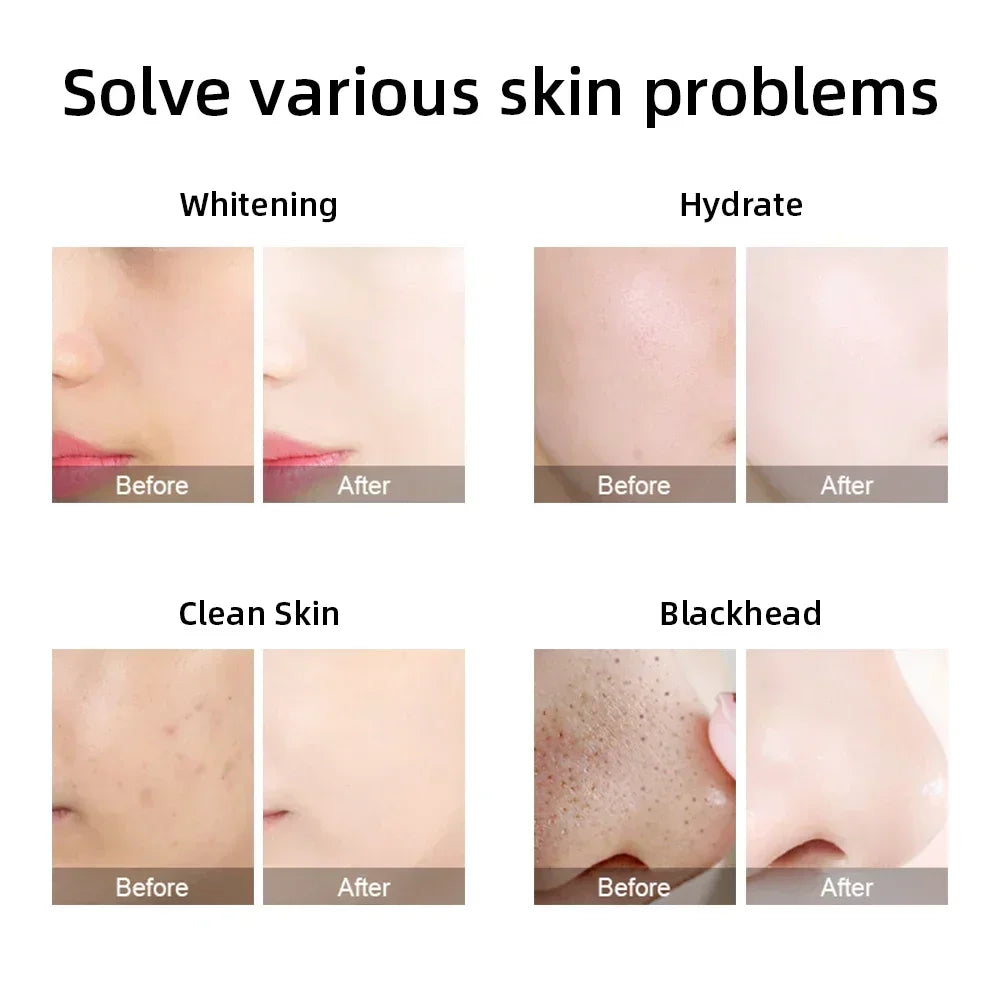 Misheart 6-in-1 Professional Beauty Facial Mask Machine Deep Cleaning Skin Care Equipment (Fast Delivery From EU Warehouse)