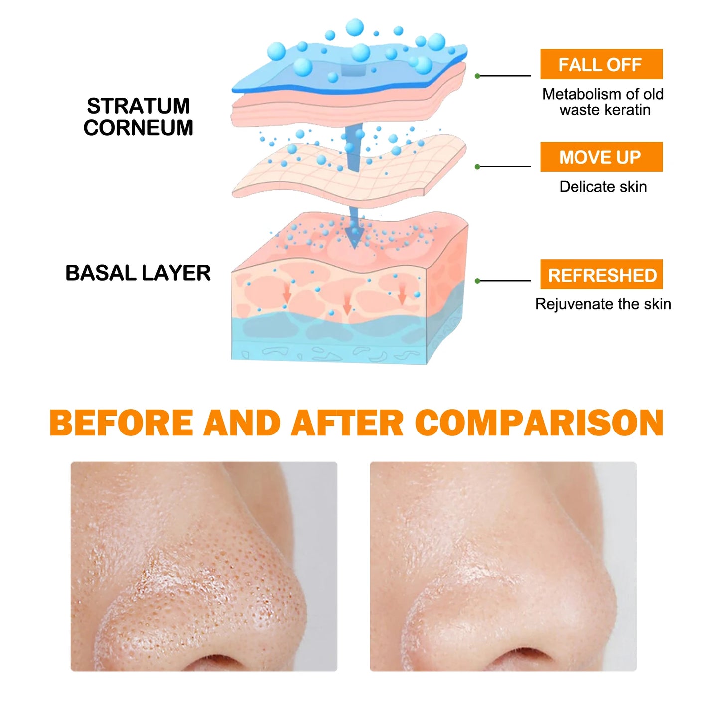 Exfoliating Blackhead Gel with Protease&Niacinamide Pore Purifying &Brighten skin tone,Ascorbic Acid,Gentle Dead Skin Remover.