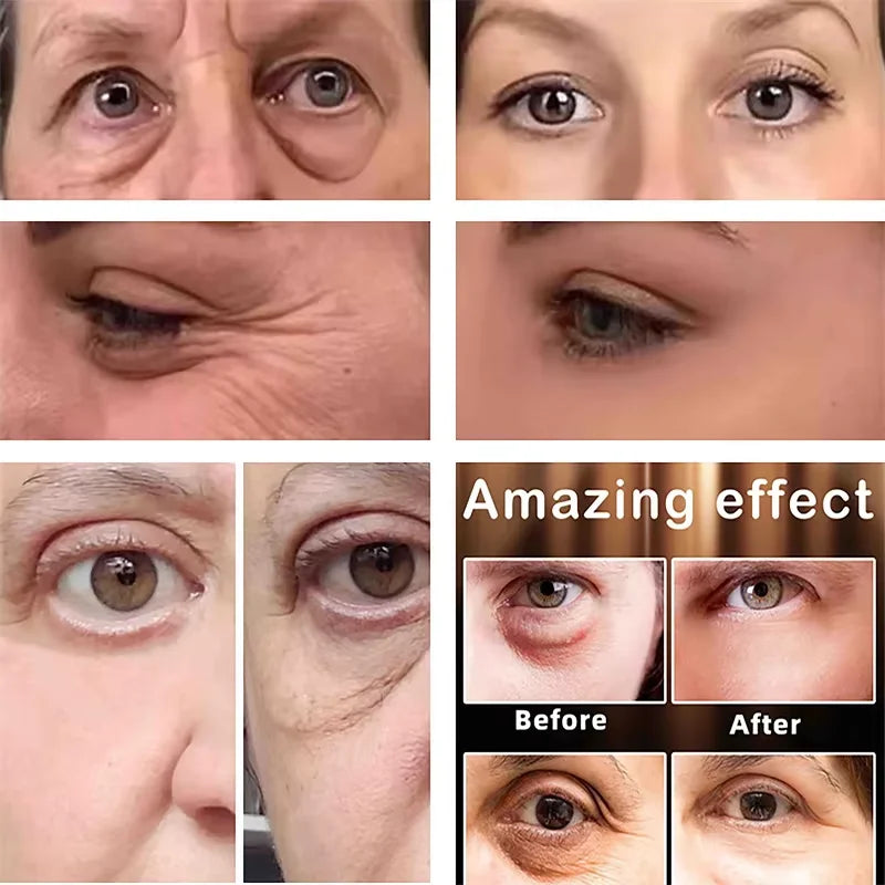 Instant Wrinkle Remove Eye Cream Collagen Remove Fine Lines Eye Bags Anti Dark Circle Puffiness Moisturizing Firming Eye Care