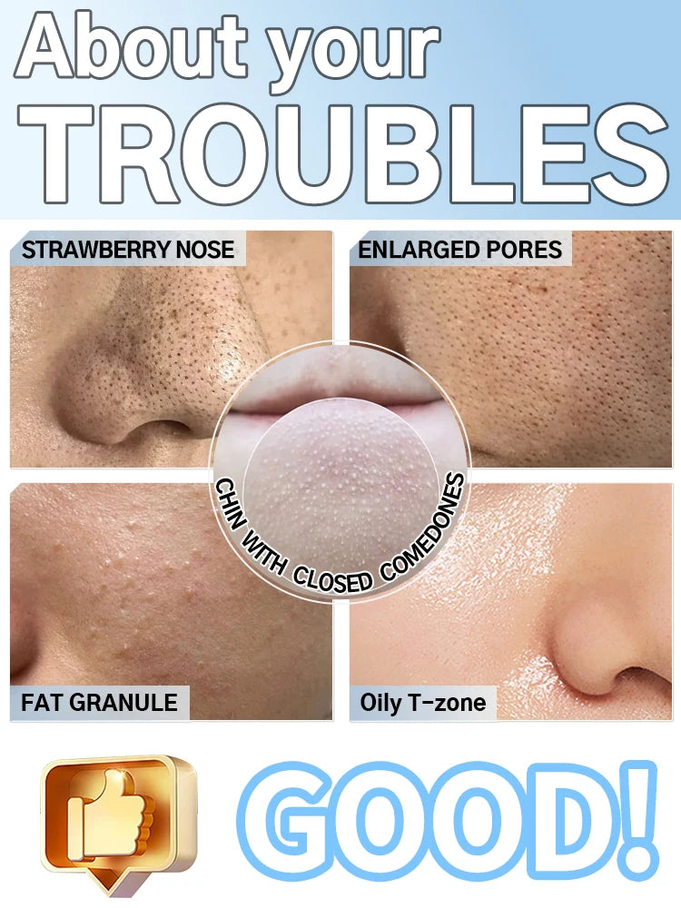 Blackhead Remover Pore Cleaner Black Dots Vacuum Cleaner Skin Pimple Acne Extractor Facial Cleaning Electric Black Head Removal.