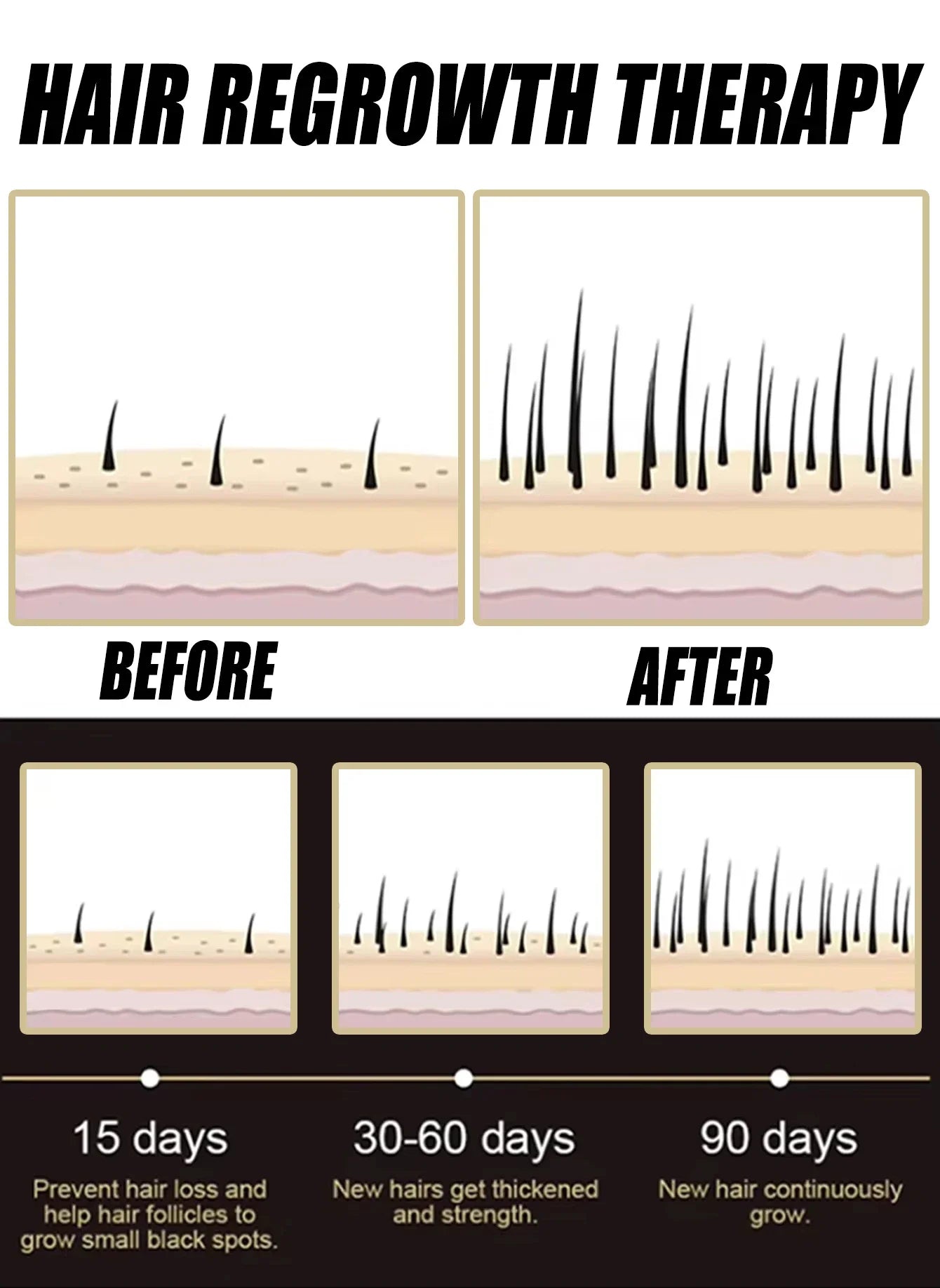 Anti-Hair Loss Essence Serum – Promotes Hair Growth & Improves Scalp Health | 1, 3, 5, 10 or 22 Pcs