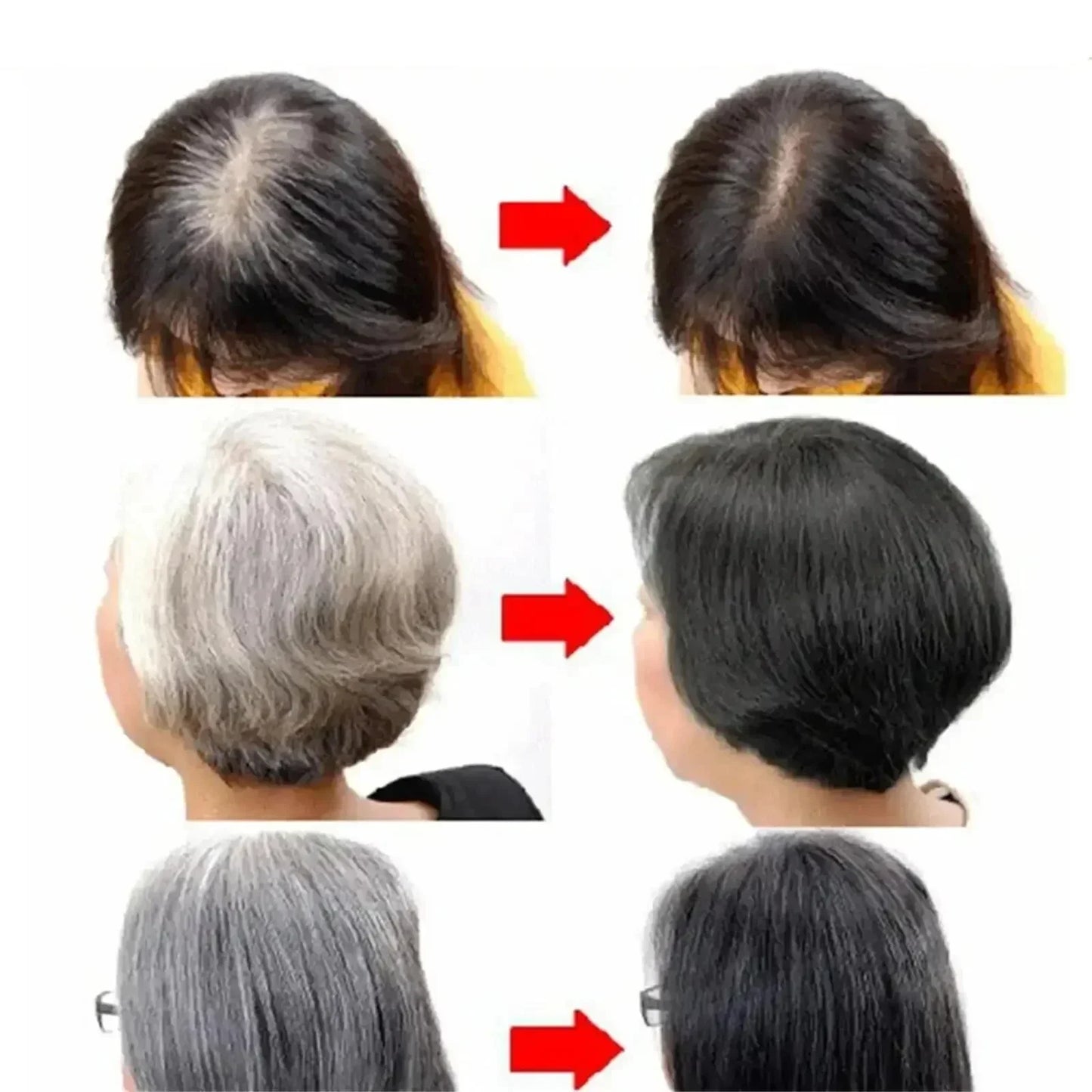 White hair killer, remove gray hair and restore natural hair color in 7 days