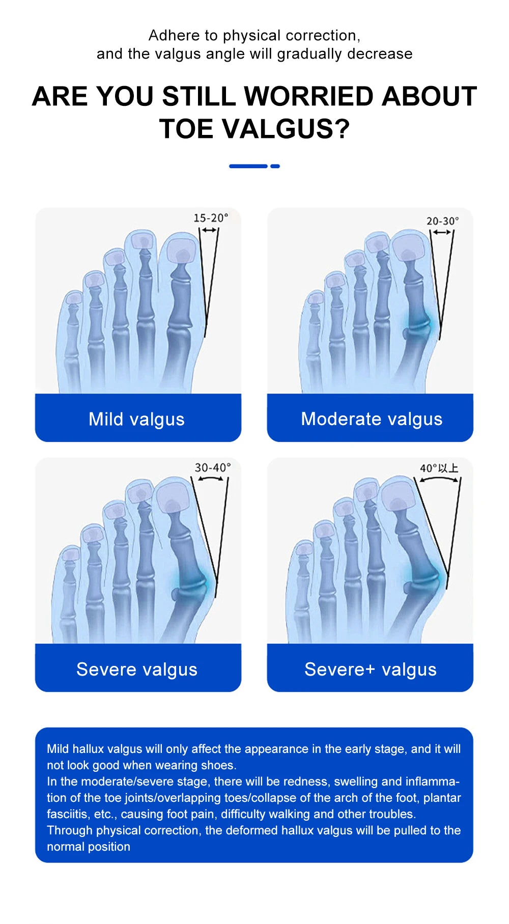 Bunion Splint Big Toe Straightener Hallux Valgus Correction Orthotics Foot Bone Thumb Adjuster Correction Bunions Corrector