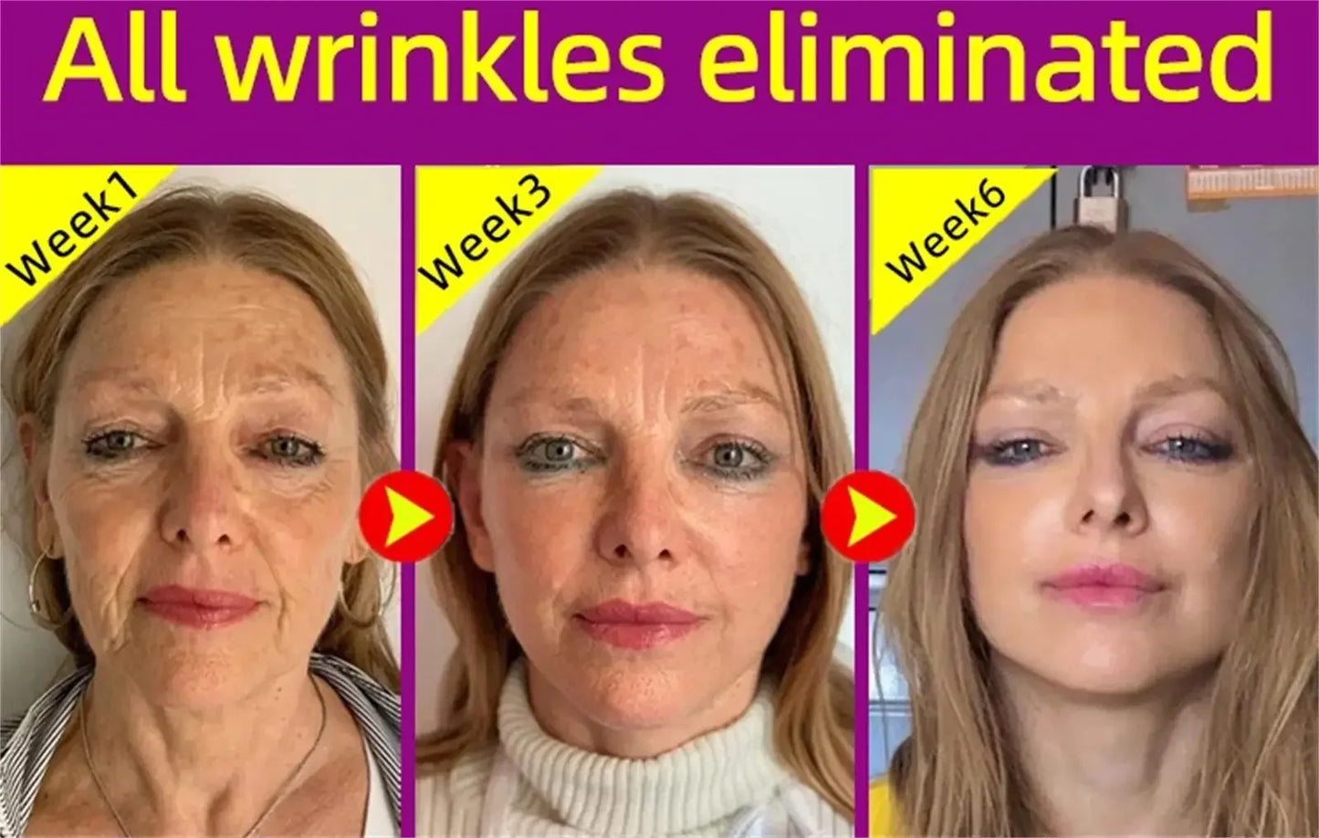 Eelhoe Collagen & Hyaluronic Acid Multi Bounce Balm Stick 9g – Instant Anti-Aging, Wrinkle Reduction, Brightening & Moisturizing | CPNP Certified