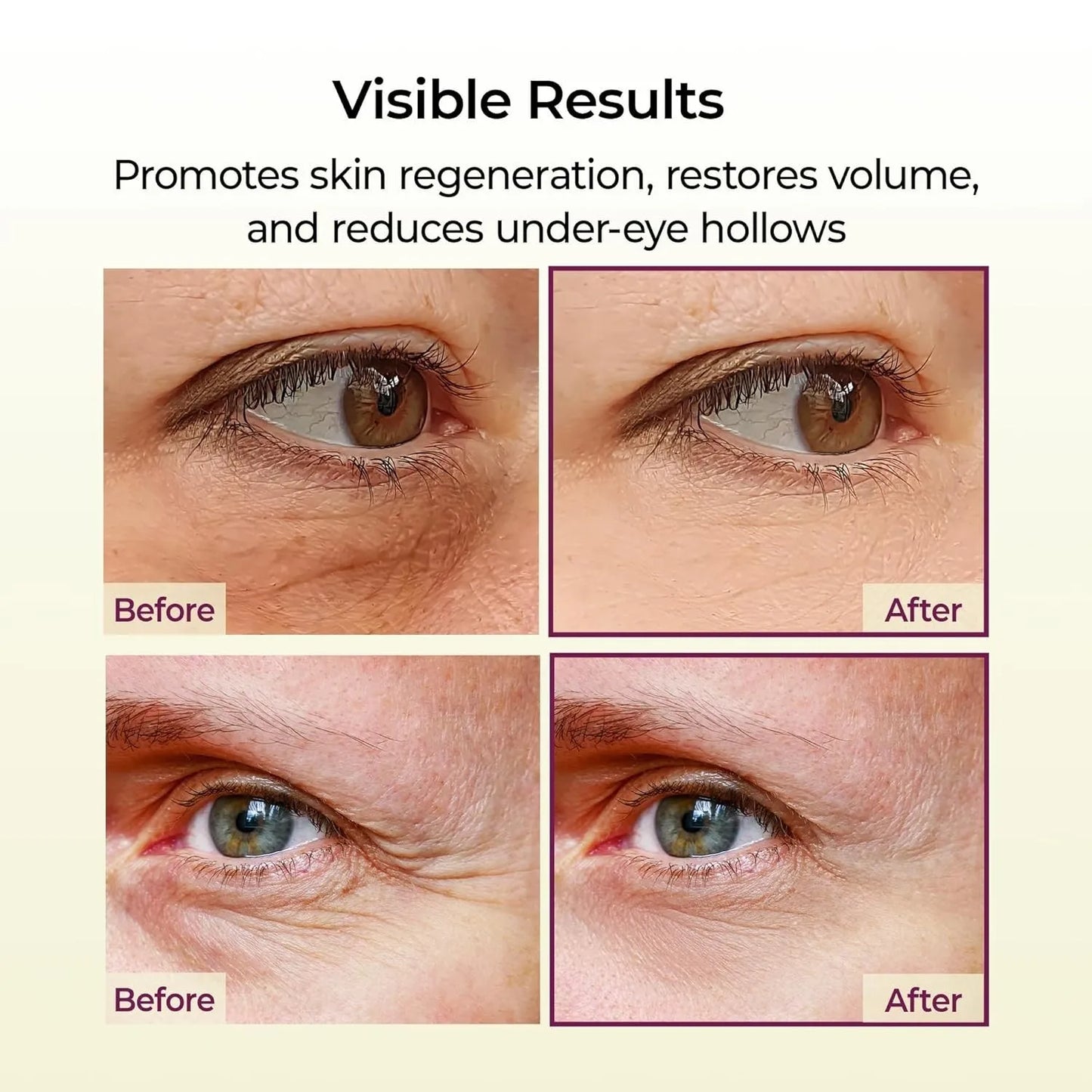 Korean Calcium Multi Balm 9g - Hypoallergenic Eye Treatment for Sensitive Skin