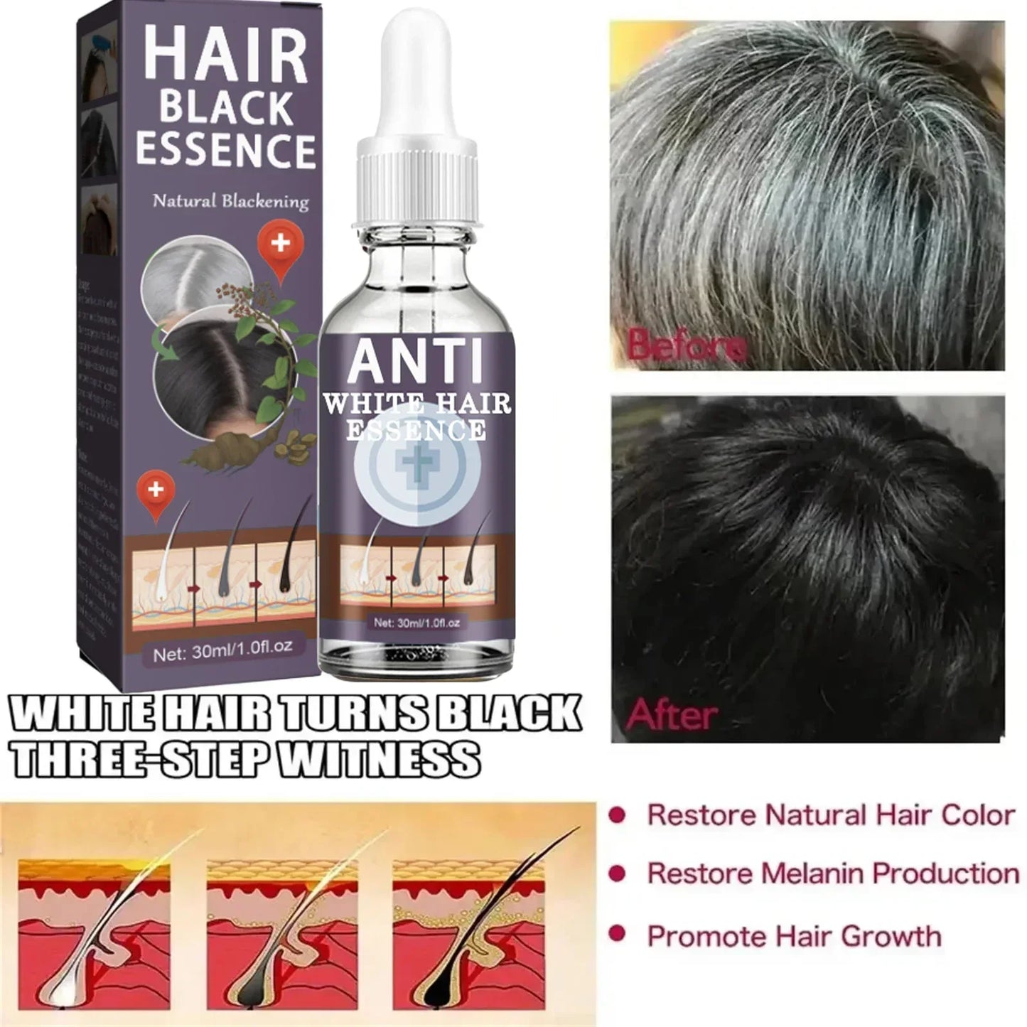 White hair killer, remove gray hair and restore natural hair color in 7 days