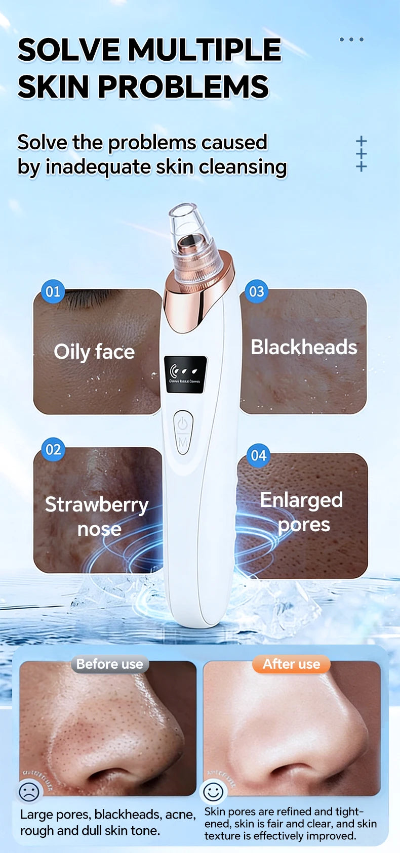 Blackhead Remover Pore Cleaner Black Dots Vacuum Cleaner Skin Pimple Acne Extractor Facial Cleaning Electric Black Head Removal.