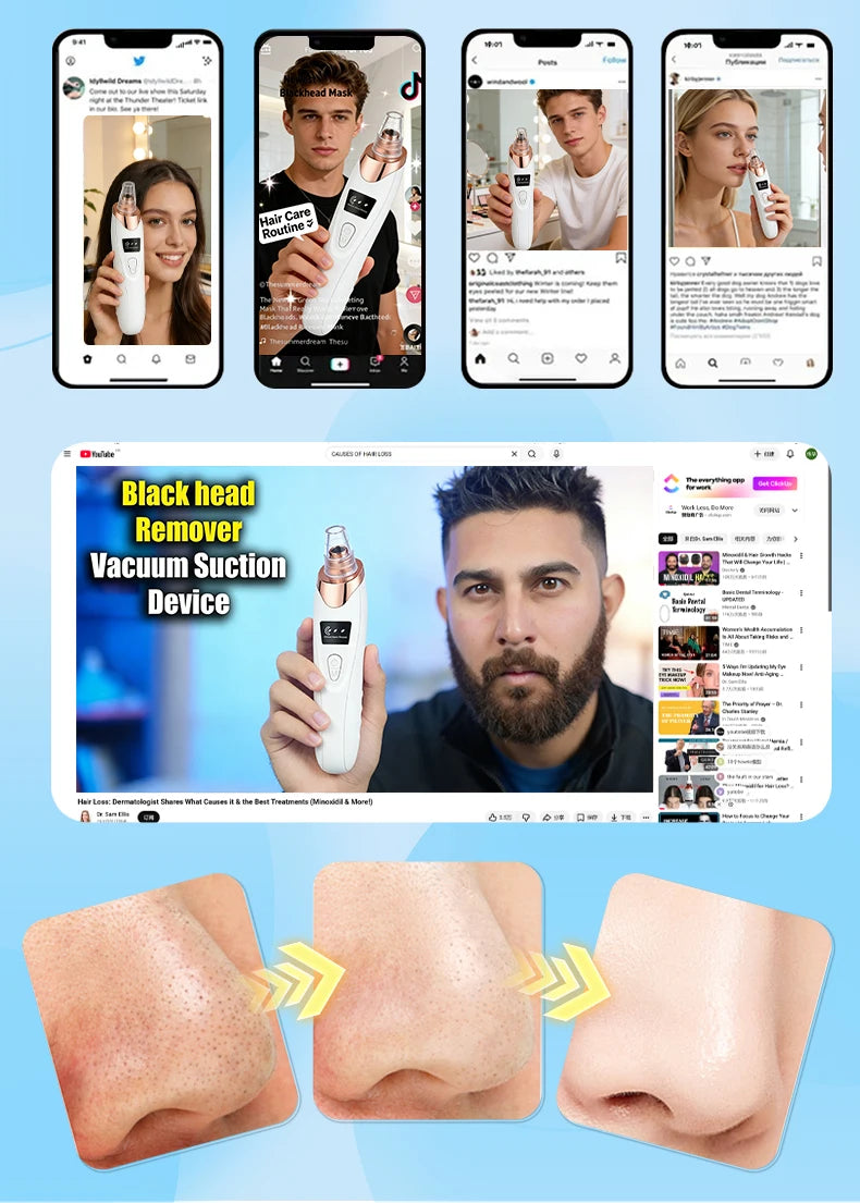 Electric Blackhead Remover Vacuum – Pore Cleaner & Acne Extractor | Facial Deep Cleaning Tool
