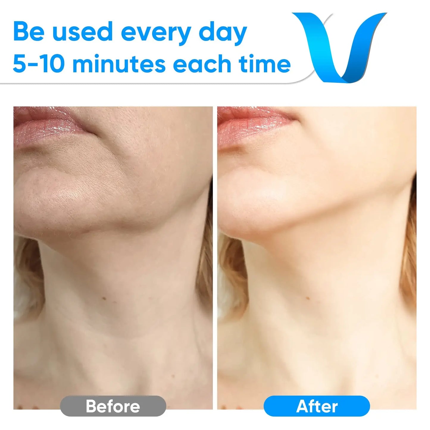 Handheld Face Massager Comfortable Facial Massager Face and Neck Beauty Device for Skin Care Adults Men and Women White