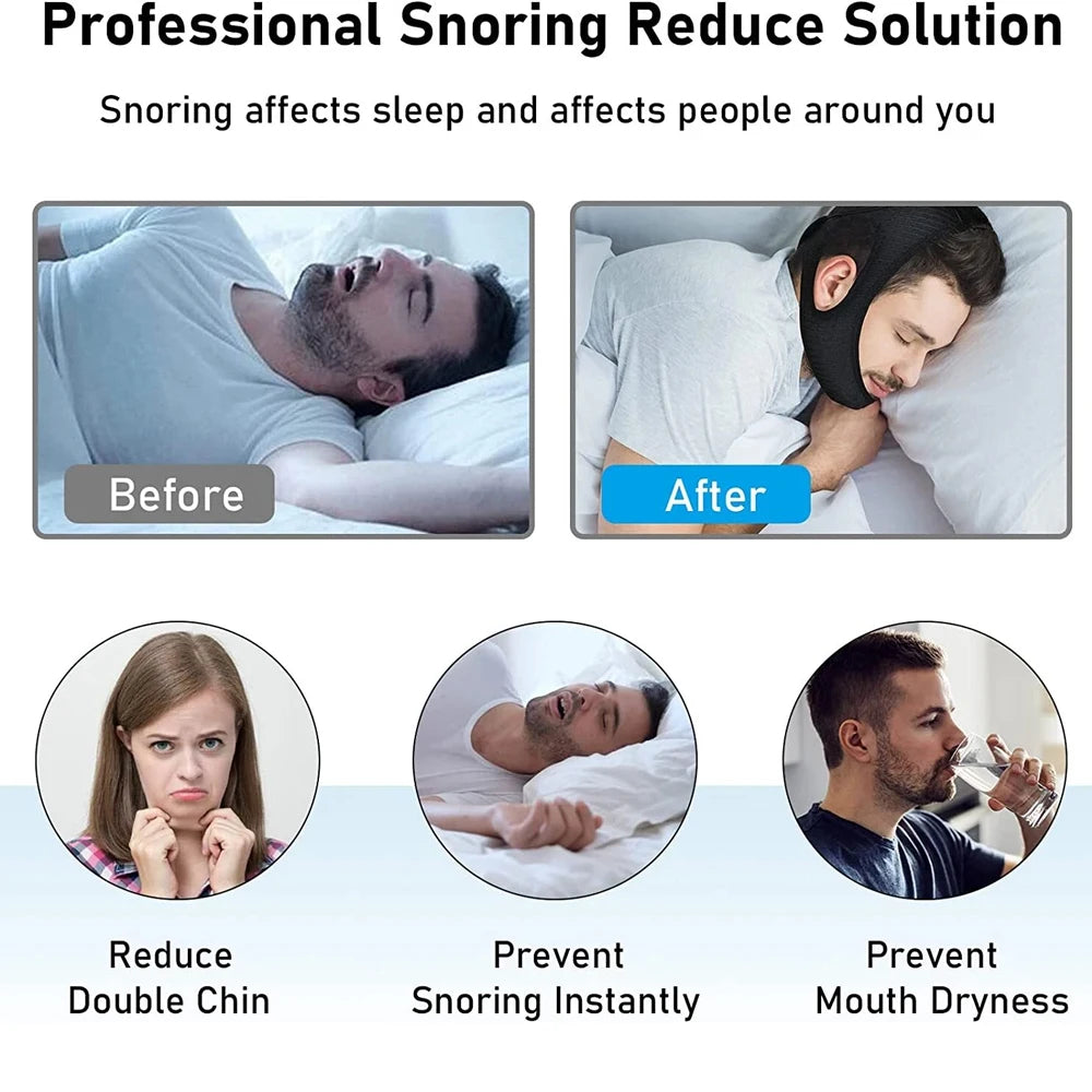 Adjustable Chin Support Strap – Jaw Support Band for More Comfortable Sleep
