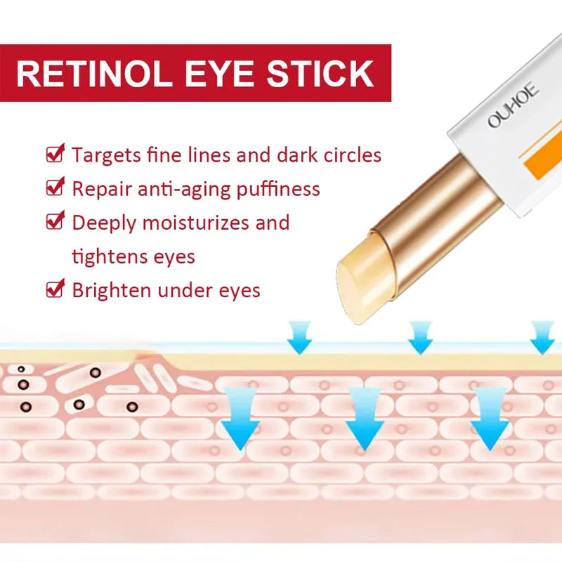 YP03 Anti wrinkle eye ointment is used for dark circles, eye bags, and puffiness