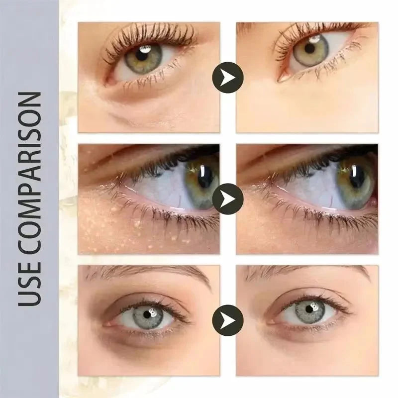 Fat Granules Remover Eye Cream Anti-Puffiness Anti Inflammatory Reduce Dark Circles Eyebags Fade Lines Moisturizing Eye Care