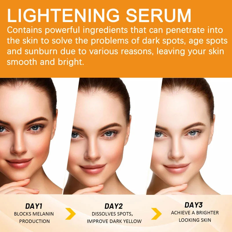 Vitamin C Brightening Facial Serum – Hyaluronic Acid, Aloe & Rose Oil | Dark Spot Care 30ml