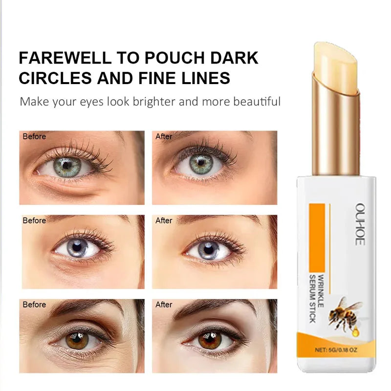 YP03 Anti wrinkle eye ointment is used for dark circles, eye bags, and puffiness