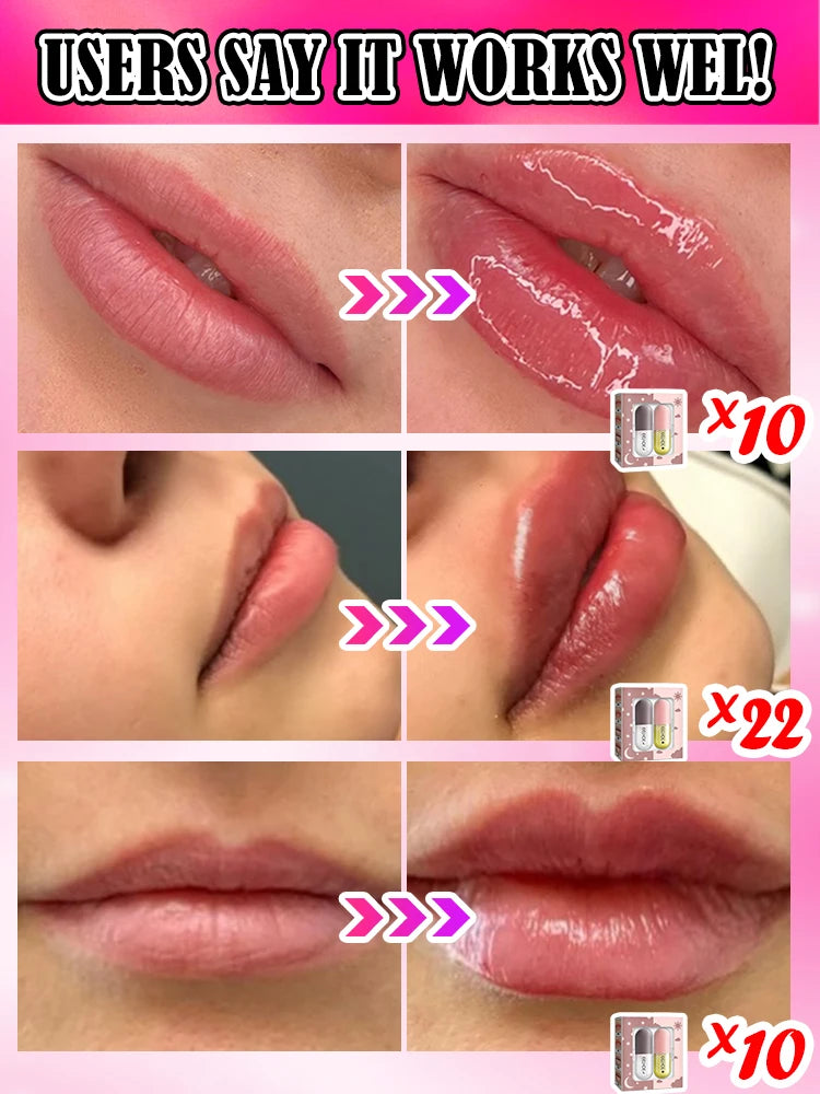 100% lip augmentation in one month
