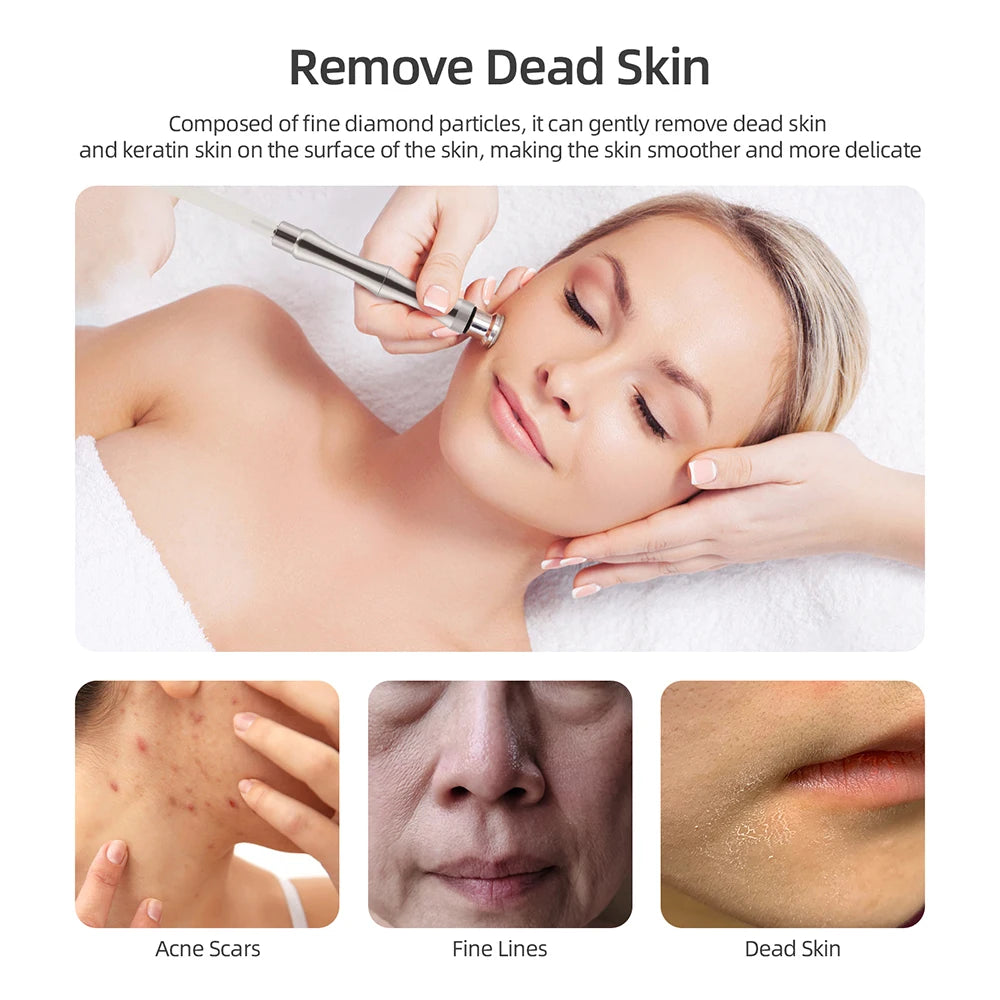 Diamond Microdermabrasion Facial Deep Cleansing Machine