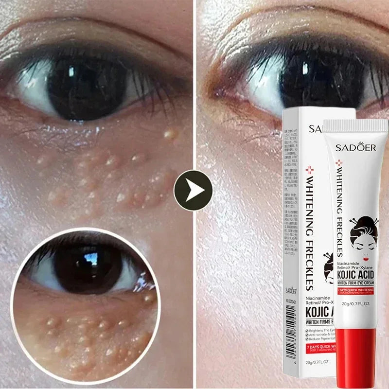 Fat Granules Remover Eye Cream Anti-Puffiness Anti Inflammatory Reduce Dark Circles Eyebags Fade Lines Moisturizing Eye Care New