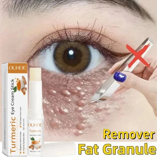 Firming Eye Stick — Smoothing Balm for Puffiness & Fine Lines