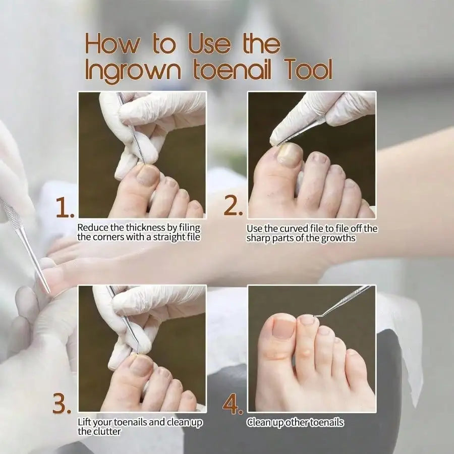 3pcs Nail Stain Removal Tool, Multifunctional Nail File, Pedicure Tool Beauty File, Ingrown Toenail Tool Pedicure Nail Cleaner