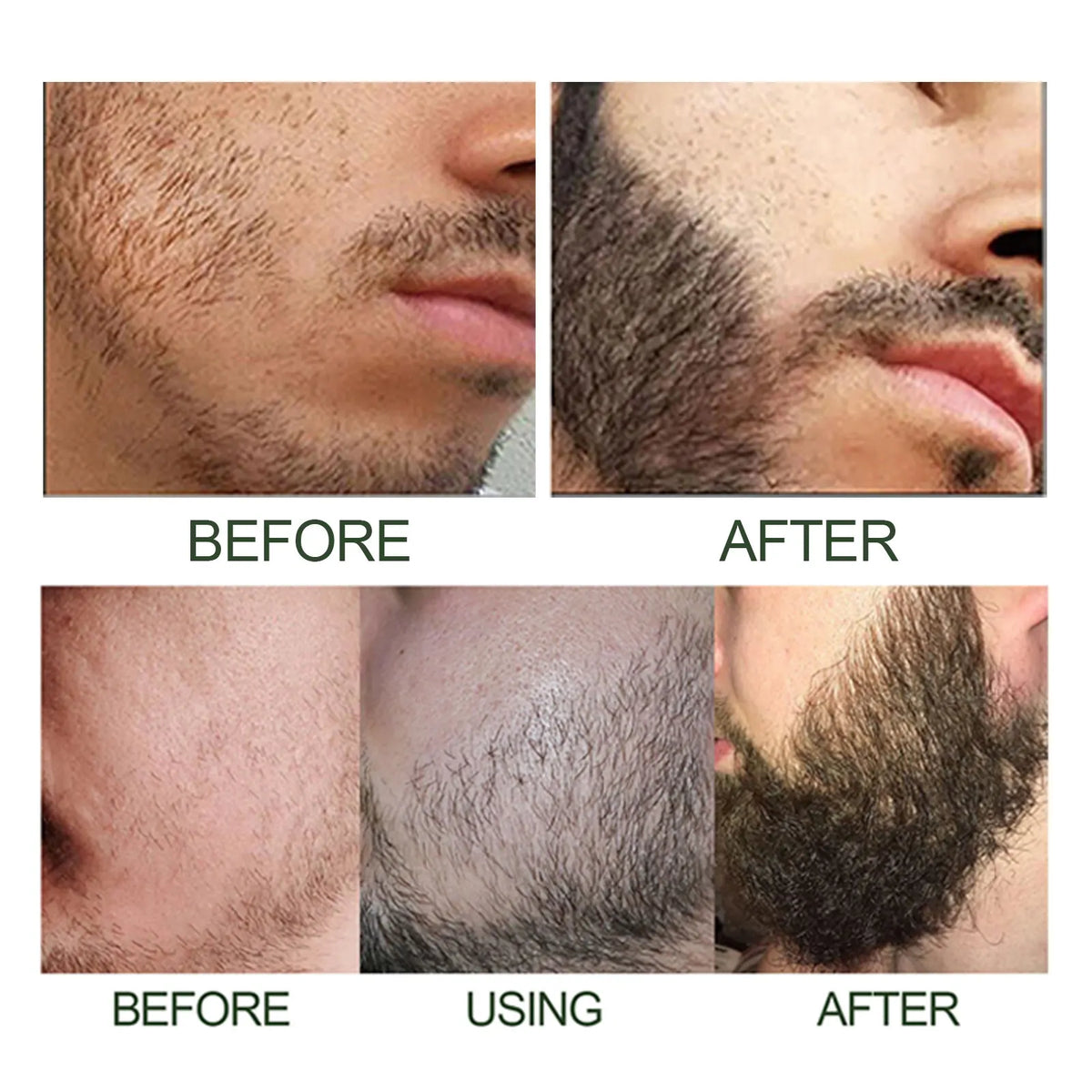 Beard Growth Serum Kit 0.2mm Derma Roller Infused Activate Hair Follicles Repair Damaged Beard Boost Fuller Thicker Beard Serum