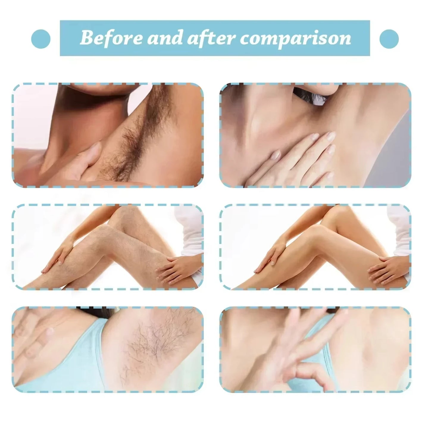 Soothing Body Cream for Post-Hair Removal - Allantoin & Lupine