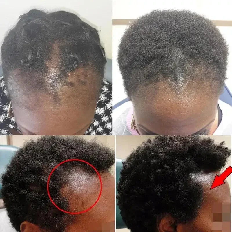 Batana Oil Hair Growth Serum Spray Repair Hair Nourish Root Regrowth Hair Anti Hair Loss Essence Men Women Hair Care Products