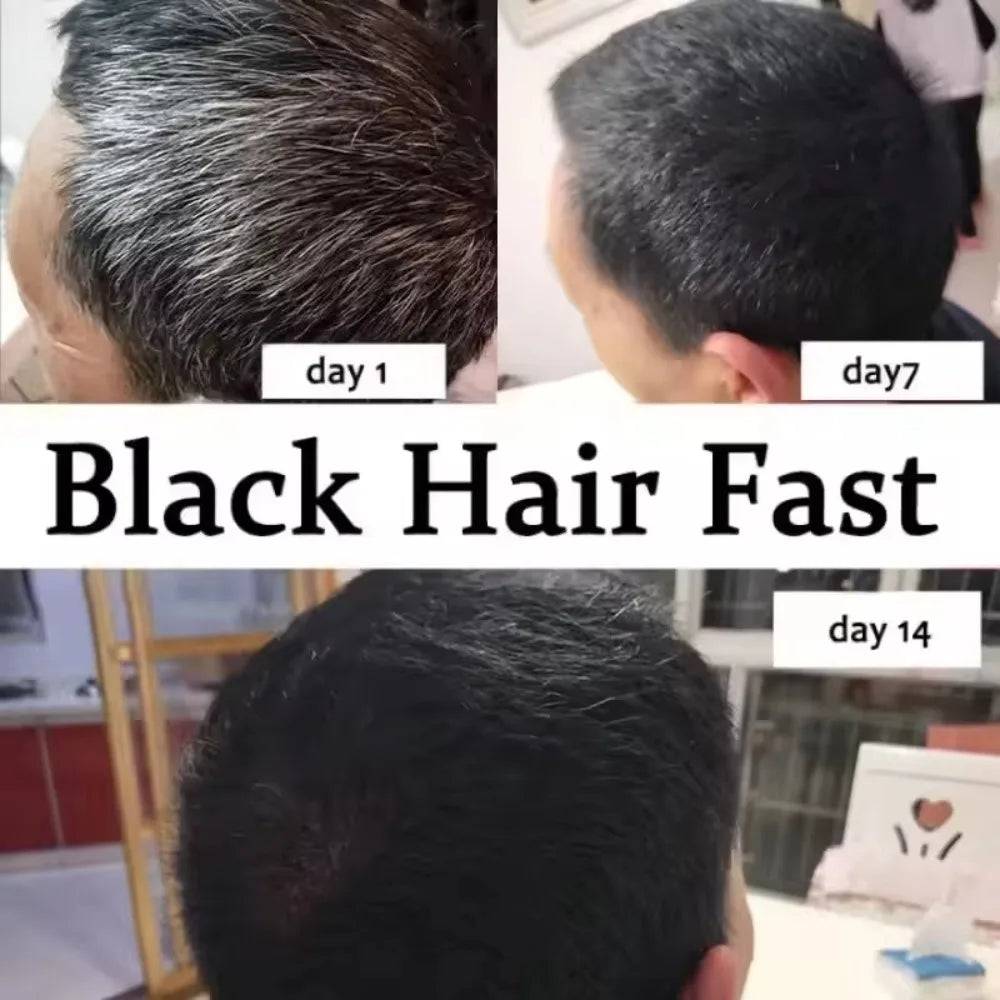Nourish Hair Roots Scalp Care Support Hair Density Boost Skin Elasticity For Thicker Healthier-Looking Hair Daily Use.