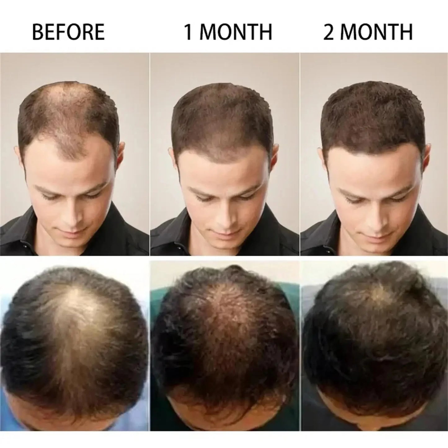 7 Days Fast Batana Oil Hair Growth Serum Anti-loss Hair Regrowth Products Repair Damaged Hair Roots Hair Care For Women Men
