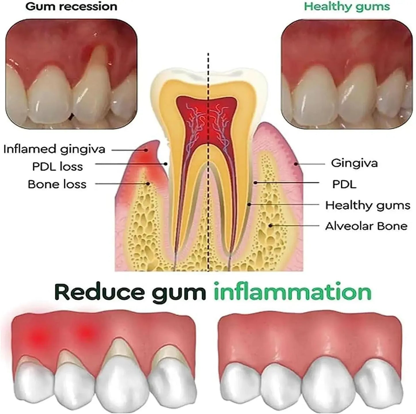 Gum Care Gel — Soothing Fresh-Breath Oral Care Toothpaste Gel