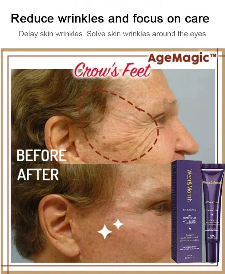 Instant Eye Bag Removal Cream Retinol Anti-Wrinkle Firming Skin Fade Fine Lines Anti Dark Circle Puffiness Brighten Eye Care Gel